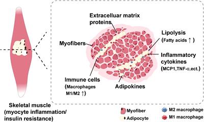 Intermuscular adipose tissue in obesity and related disorders: cellular origins, biological characteristics and regulatory mechanisms